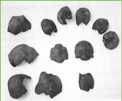 Figure 3: The remains of 4 children from Rogaland (Lillehammer 2001, 49).